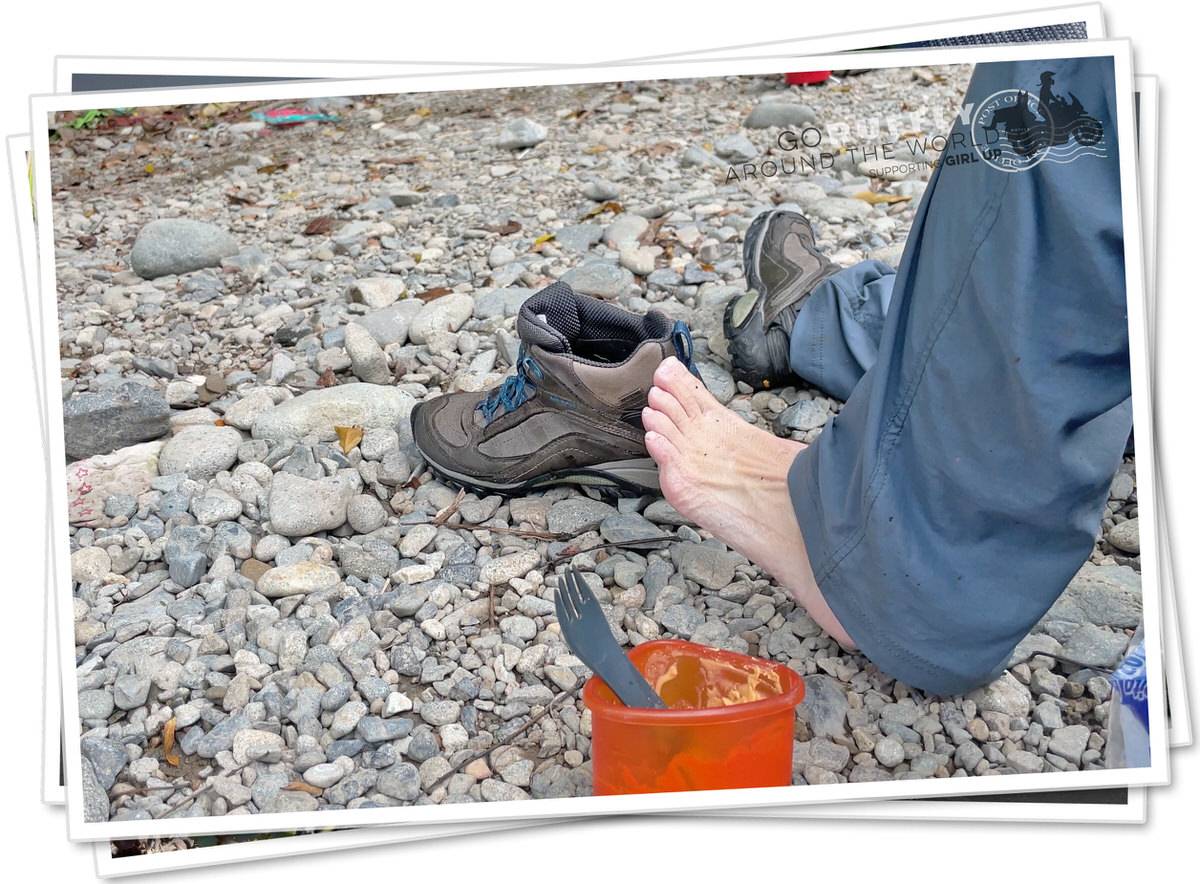 Broken hiking boots beside blistered feet
